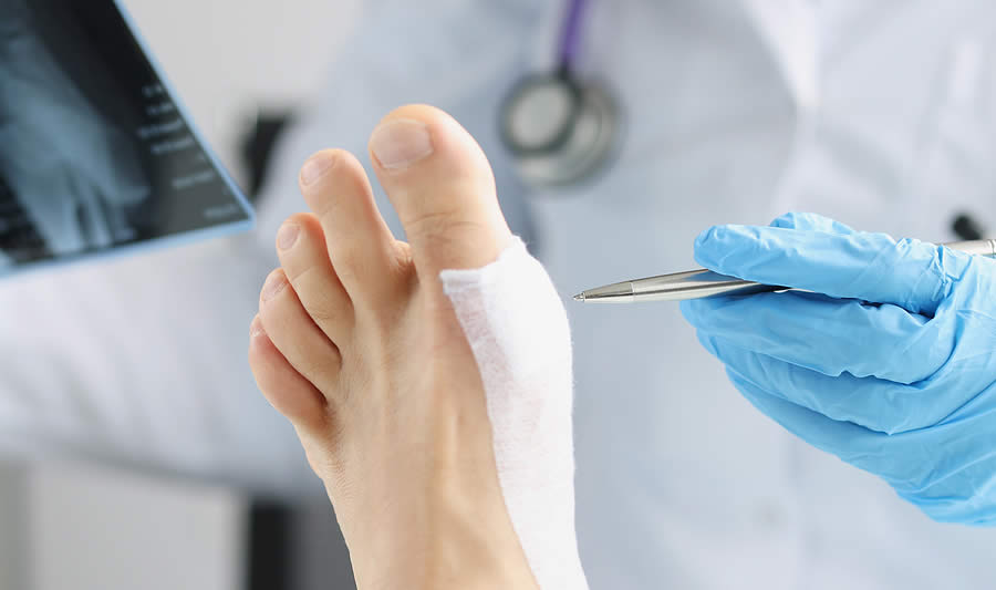 Will You Need Surgery to Fix Your Hammer Toe?